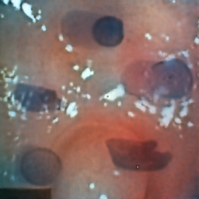 Kvasir-SEG input captured through the hyperbolic metalens
