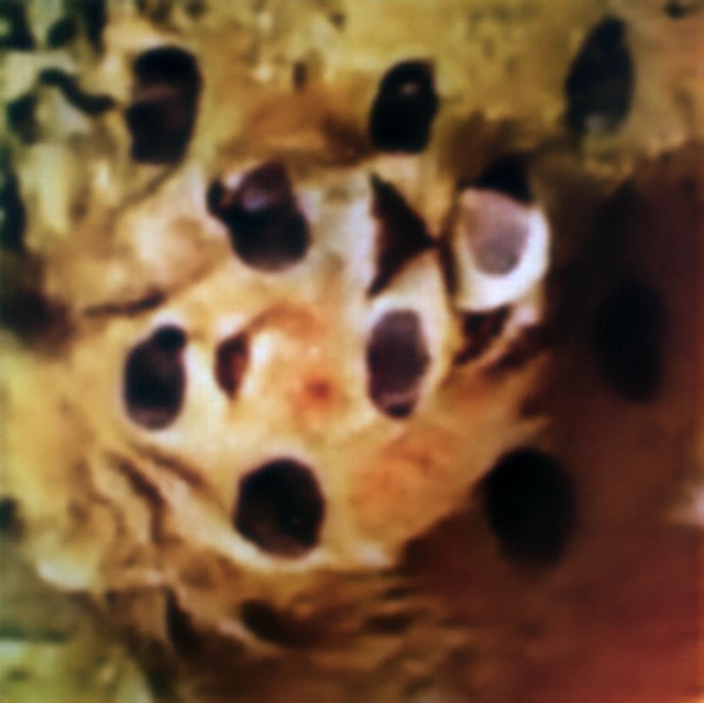Hyperbolic metalens dynamic reconstruction at frame two